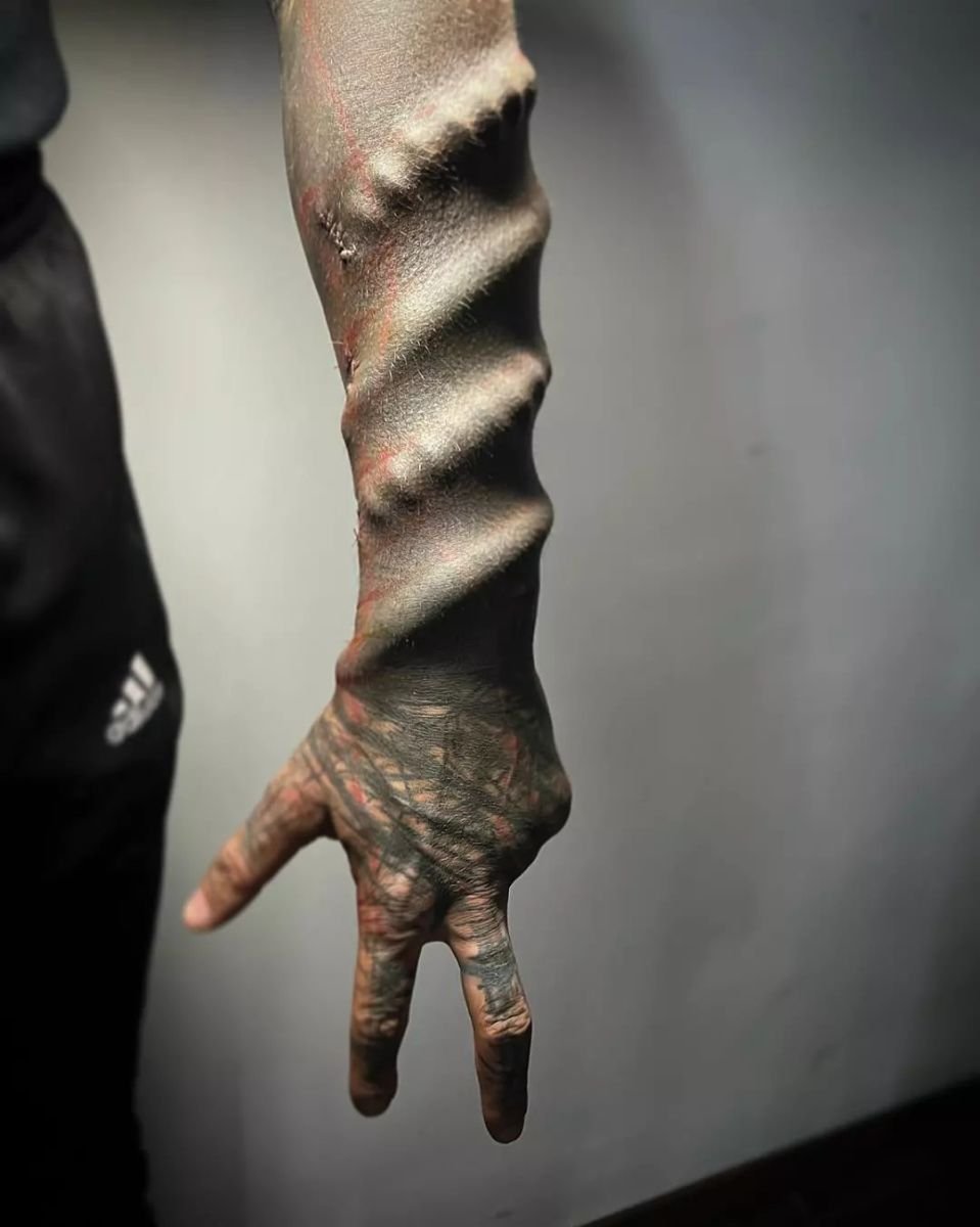 Anthony Loffredo's left arm which shows two missing fingers that were removed surgically and a coil that looks surgically inserted under his arm's skin, Photo Credit: the_black_alien_project/Instagram